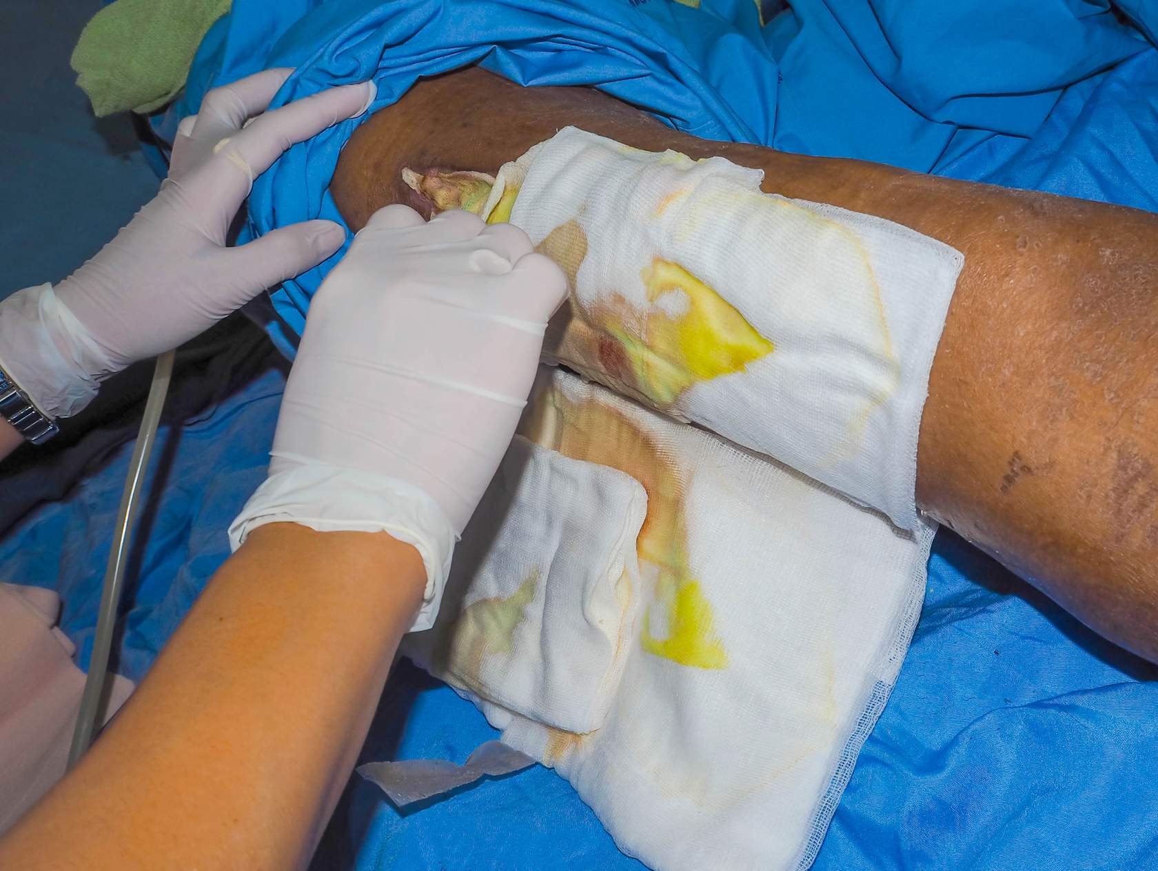 Post-op Wound Care • CAN-Sim